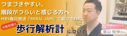 歩行分析